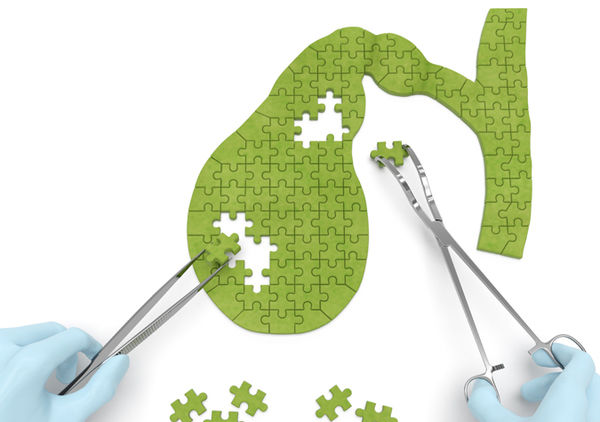 В помощь хирургу. Острый холецистит. Часть 1