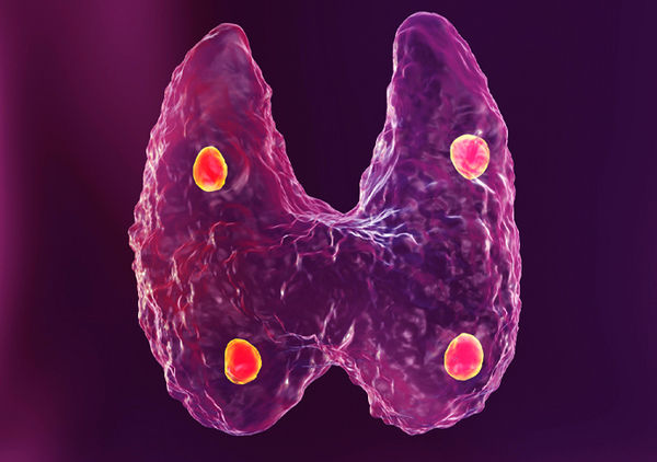 Гипопаратиреоз