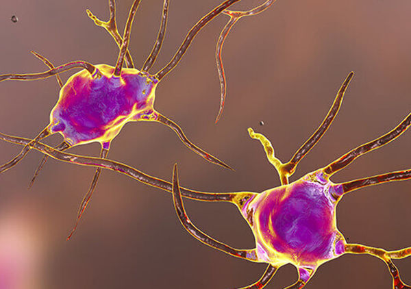 Иммунные клетки мозга