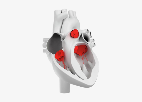 Влияние острой ревматической лихорадки на сердечные клапаны