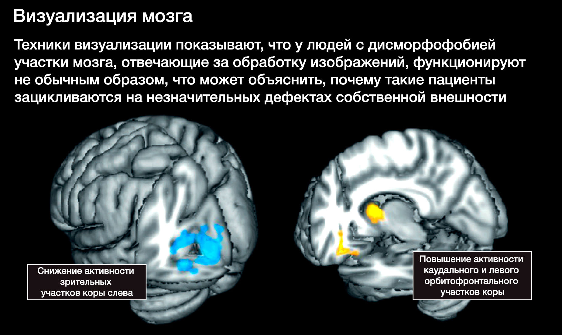 Мозговая техника. Визуализация мозга. Курсы во визуализации в мозге.