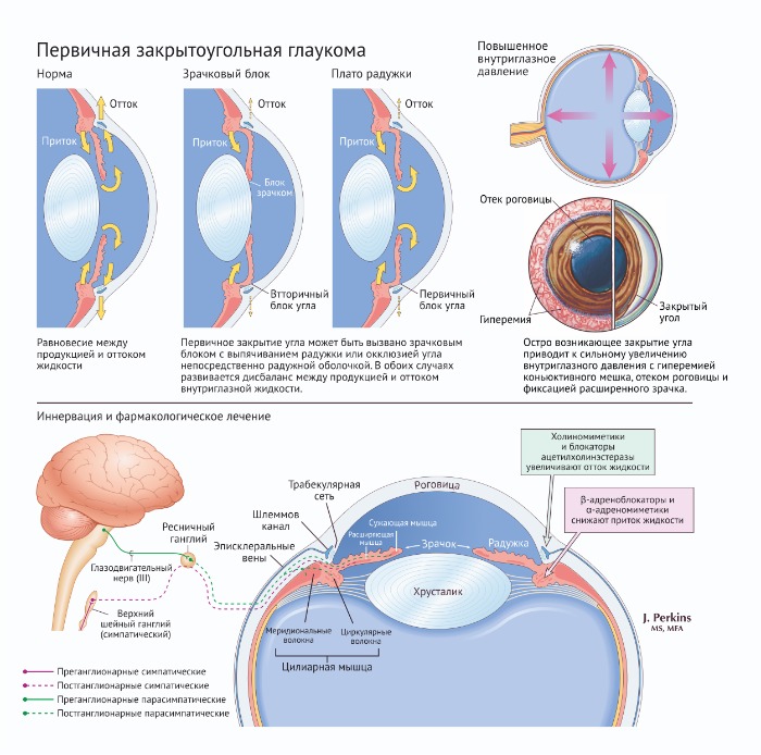 Механизм действия при глаукоме