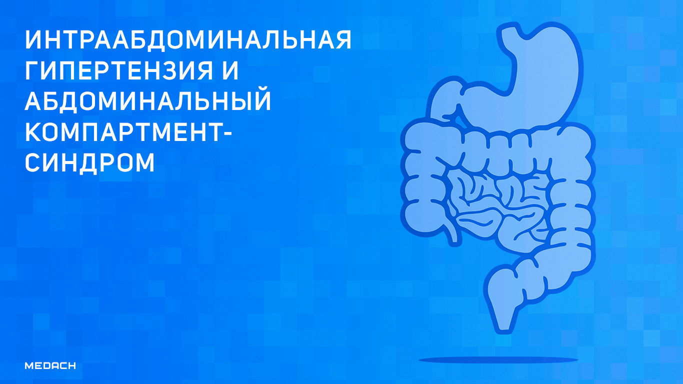 Компартмент синдром фото