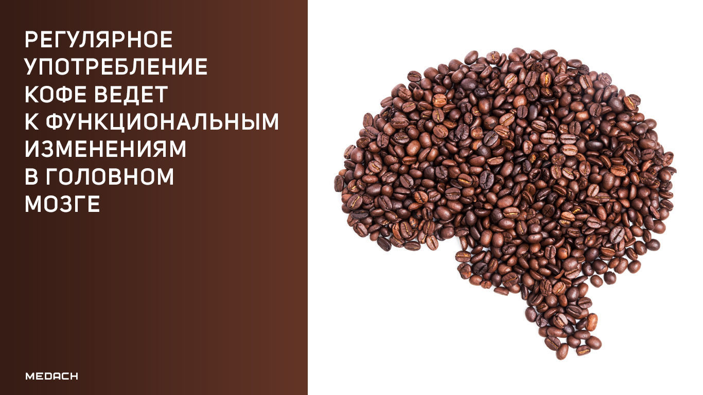 Как кофе влияет на память — научные факты о том, полезен ли он для улучшения запомнания информации и внимания