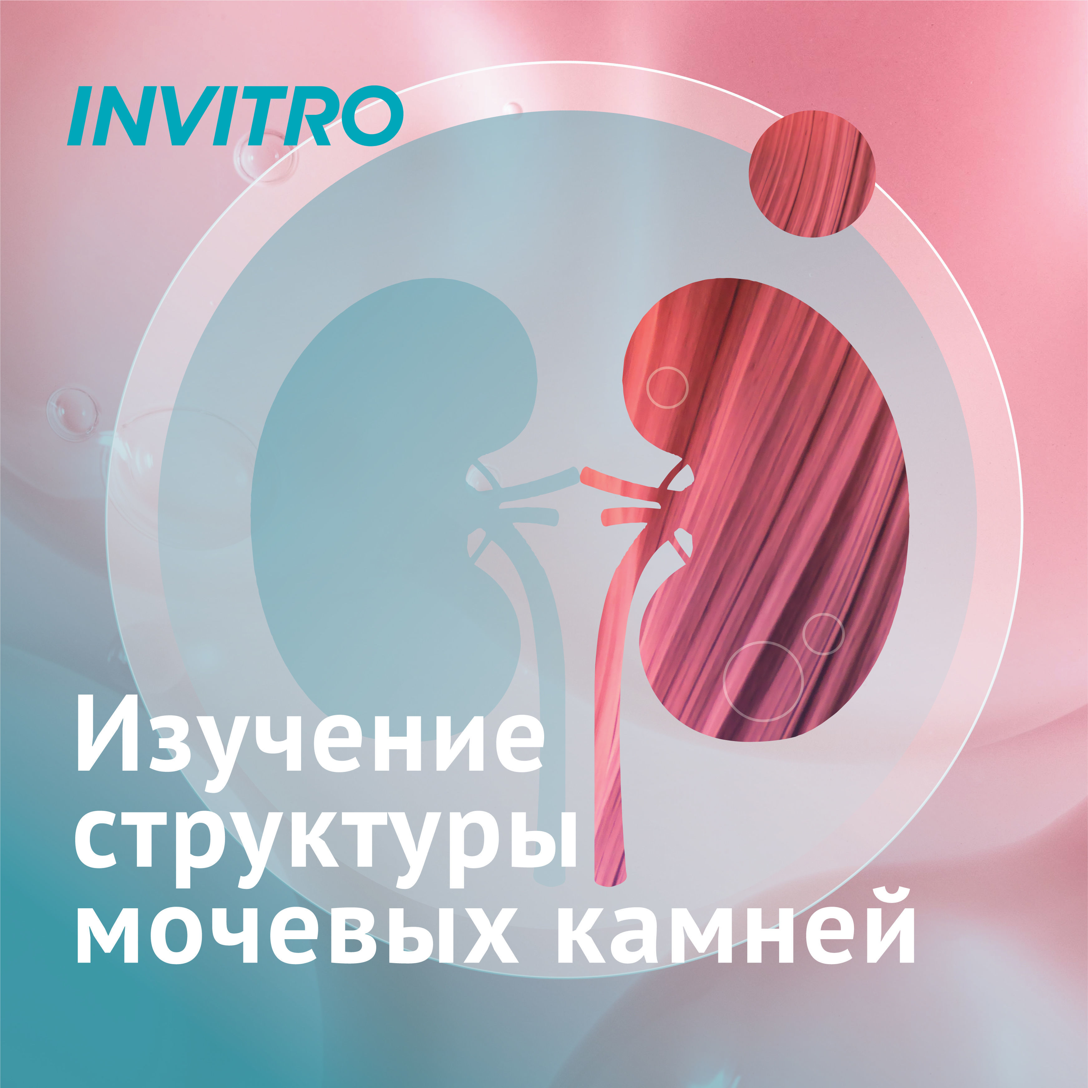 Изучение структуры мочевых камней