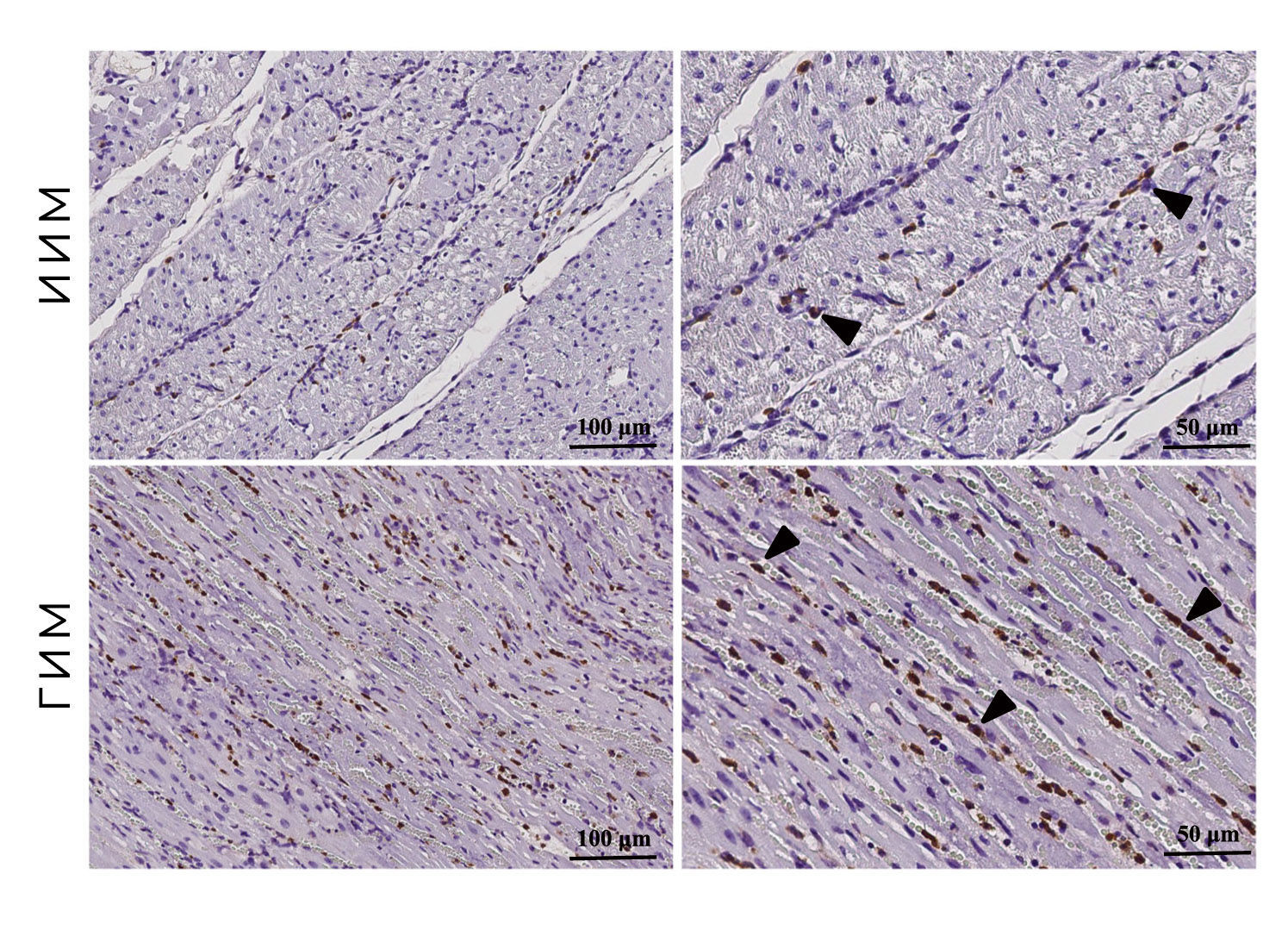 Qwo staining