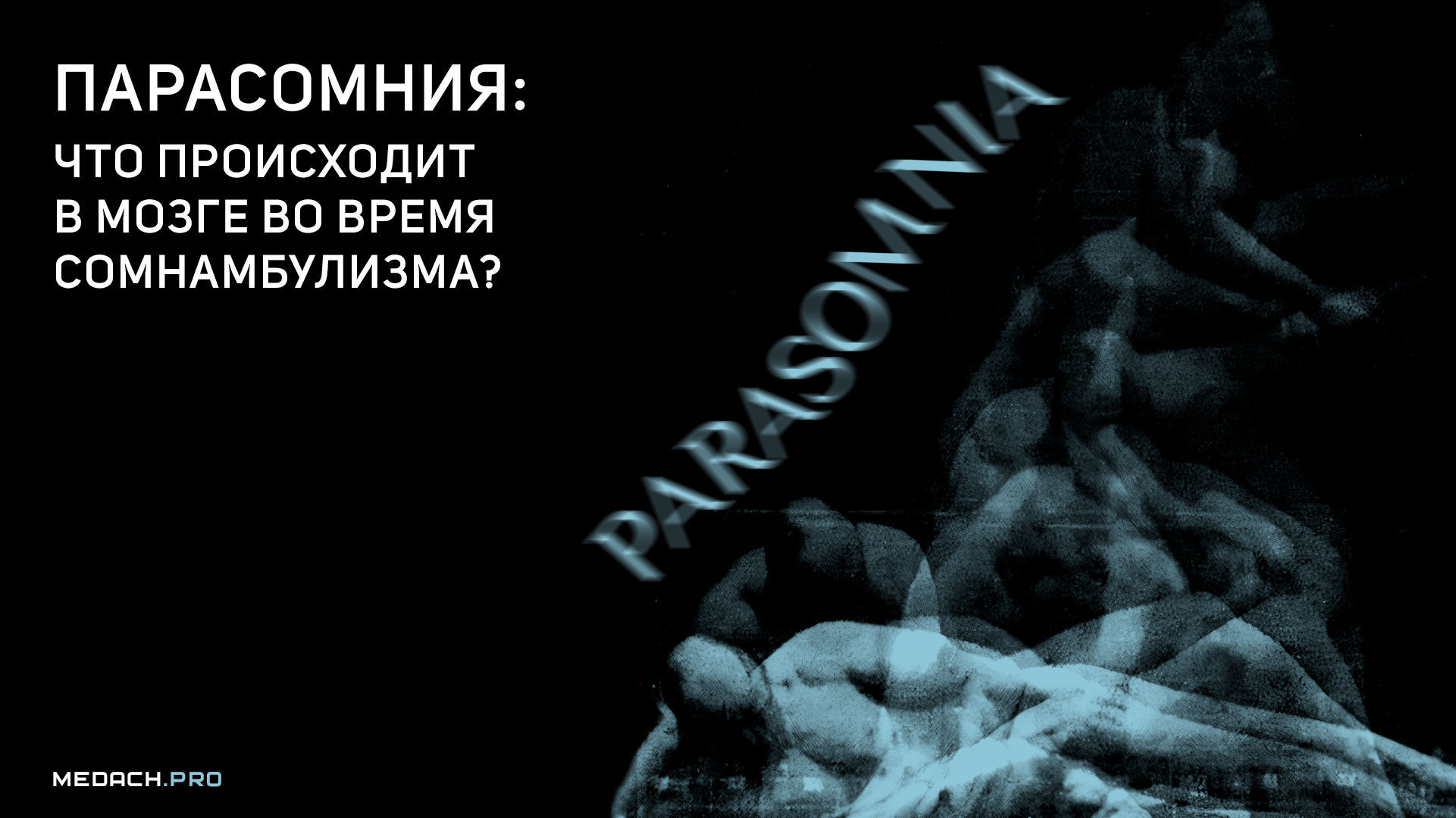 Парасомния: что происходит в мозге во время сомнамбулизма?