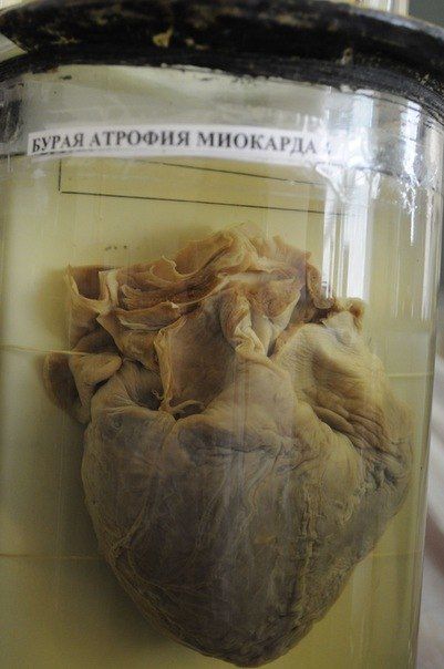 Что такое патологическая анатомия. Смотреть фото Что такое патологическая анатомия. Смотреть картинку Что такое патологическая анатомия. Картинка про Что такое патологическая анатомия. Фото Что такое патологическая анатомия